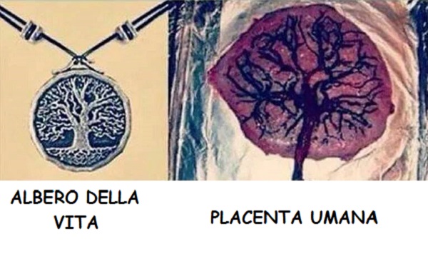 placenta3